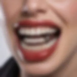 Close-up of vampire fangs incorporated into braces